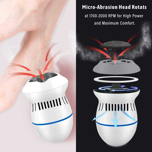 Electric Foot Callus Remover – Foot Hard & Dead Skin Removal Machine